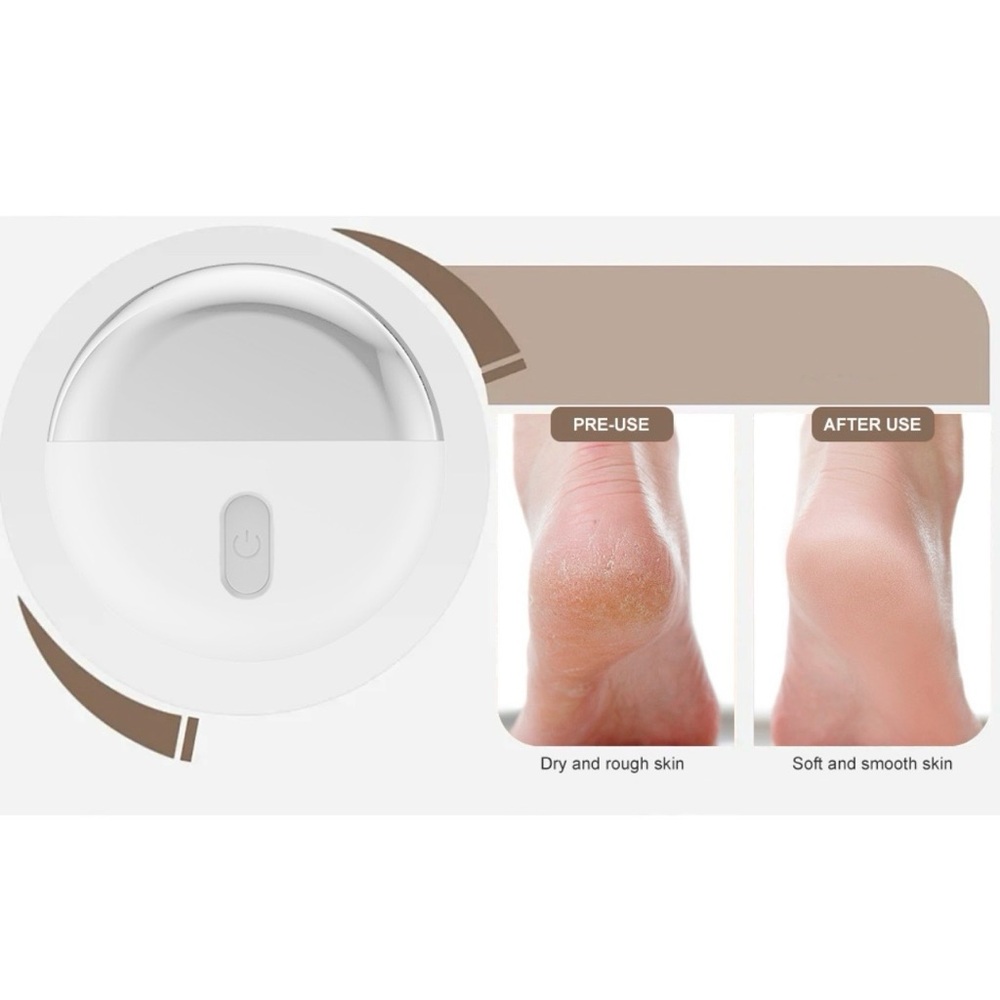 Electric Callus Remover - Picture 8 of 11